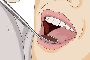 吸附性义齿是什么?和传统假牙哪个更好?少牙的老年人要注意了 吸附性义齿是什么?和传统假牙哪个更好?少牙的老年人要注意了