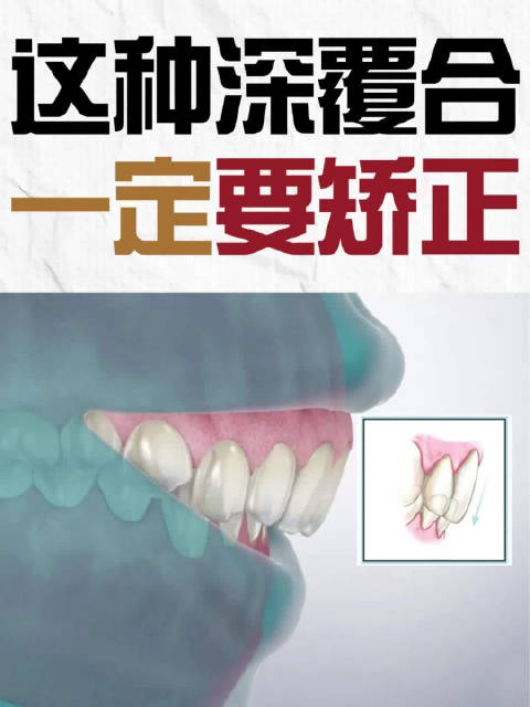 青岛牙齿矫正选哪家?亿口康口腔精准矫治+惠民补贴,轻松拥有整齐牙齿 青岛牙齿矫正选哪家?亿口康口腔精准矫治+惠民补贴,轻松拥有整齐牙齿