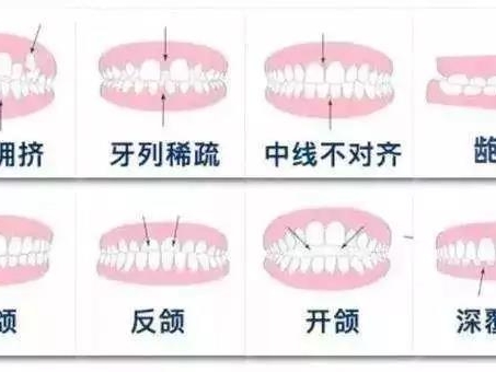 常州牙齿矫正哪里好？正规正畸机构推荐：常州钟楼区北极星口腔医院（钟楼总院）